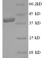 Human Annexin A1 (ANXA1), partial Recombinant Protein - BioCrest Sci