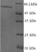 Human Exonuclease V (EXO5) Recombinant Protein - BioCrest Sci