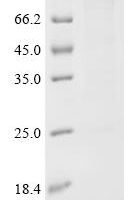 Escherichia coli Cellulose synthase operon protein C (bcsC) Recombinant Protein - BioCrest Sci