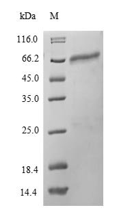 Mouse Protein disulfide-isomerase A2 (Pdia2) Recombinant Protein, N-His-SUMO, Mus musculus (Mouse), E.coli, N-terminal 6xHis-SUMO-tagged, 72.2 kDa, purity >≥ 90% as determined by SDS-PAGE.
