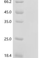 Human Bromodomain-containing protein 4 (BRD4), partial Recombinant Protein, N-10His - BioCrest Sci