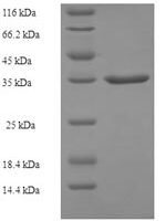 Human Alpha-ketoglutarate-dependent dioxygenase alkB homolog 3 (ALKBH3) Recombinant Protein, N-His-SUMO - BioCrest Sci