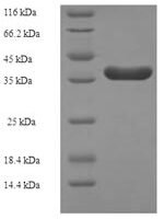 Human Core-binding factor subunit beta (CBFB) Recombinant Protein - BioCrest Sci