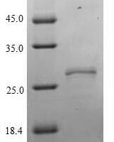 Human Neurexophilin-2 (NXPH2) Recombinant Protein - BioCrest Sci
