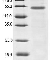 Human Myomegalin (PDE4DIP) Recombinant Protein - BioCrest Sci