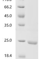 Mouse Prolactin (Prl) Recombinant Protein, Tag-Free - BioCrest Sci