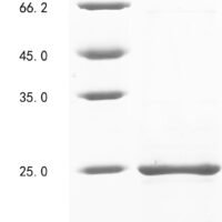 Mouse Tumor rejection antigen P815A (Trap1a), partial Recombinant Protein - BioCrest Sci