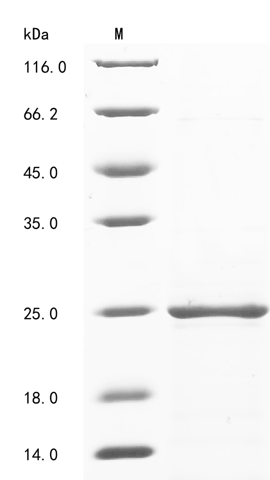 Mouse Tumor rejection antigen P815A (Trap1a), partial Recombinant Protein, Mus musculus (Mouse), E.coli, N-terminal 10xHis-tagged and C-terminal Myc-tagged, 23.1 kDa, purity >≥ 90% as determined by SDS-PAGE.