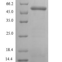 Human Paraneoplastic antigen Ma2 (PNMA2), partial Recombinant Protein, N-His-SUMO - BioCrest Sci