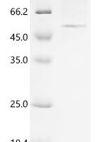 Human 1-acylglycerol-3-phosphate O-acyltransferase PNPLA3 (PNPLA3) (I148M) Recombinant Protein - BioCrest Sci