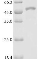 Plasmodium falciparum Merozoite surface protein 1 (MSP1), partial Recombinant Protein, C-His - BioCrest Sci