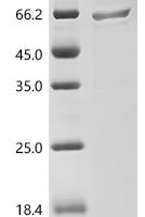 Human Transcription factor EB (TFEB) Recombinant Protein, N-His - BioCrest Sci