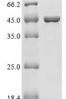 Human UMP-CMP kinase 2, mitochondrial (CMPK2) Recombinant Protein - BioCrest Sci