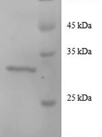 Human Agouti-related protein (AGRP) Recombinant Protein, N-GST - BioCrest Sci