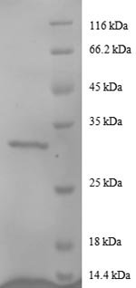 Human Agouti-related protein (AGRP) Recombinant Protein, N-GST, Homo sapiens (Human), E.coli, N-terminal GST-tagged, 32.7 kDa, purity >≥ 90% as determined by SDS-PAGE.