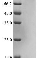 Human Olfactomedin-like protein 2B (OLFML2B) Recombinant Protein - BioCrest Sci