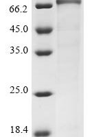 Human Choline O-acetyltransferase (CHAT),Partial Recombinant Protein, N-His - BioCrest Sci