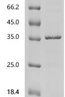 Human Cytochrome c1, heme protein, mitochondrial (CYC1) Recombinant Protein, C-His - BioCrest Sci