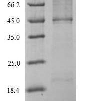 Mouse Nuclear receptor ROR-gamma (Rorc) Recombinant Protein - BioCrest Sci
