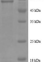Human Serine/threonine-protein phosphatase 2A catalytic subunit beta isoform (PPP2CB) Recombinant Protein - BioCrest Sci