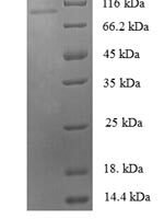 Human Zinc finger protein 175 (ZNF175) Recombinant Protein - BioCrest Sci