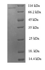 Human Zinc finger protein 175 (ZNF175) Recombinant Protein, Homo sapiens (Human), E.coli, N-terminal 6xHis-SUMO-tagged, 97.6 kDa, purity >≥ 90% as determined by SDS-PAGE.