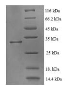 Human ATP synthase mitochondrial F1 complex assembly factor 2 (ATPAF2) Recombinant Protein - BioCrest Sci