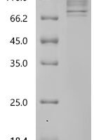 HumanReceptor-type tyrosine-protein phosphatase alpha (PTPRA)-Detergent Recombinant Protein - BioCrest Sci