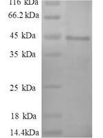 Human Myosin light polypeptide 6 (MYL6), partial Recombinant Protein - BioCrest Sci