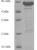 Human Cadherin-1 (CDH1), partial Recombinant Protein - BioCrest Sci
