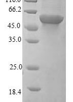 Human Insulin receptor (INSR),Partial Recombinant Protein - BioCrest Sci