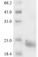 Mouse Myelin-oligodendrocyte glycoprotein (Mog), partial Recombinant Protein - BioCrest Sci