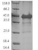 Human Cytosolic beta-glucosidase (GBA3) Recombinant Protein - BioCrest Sci