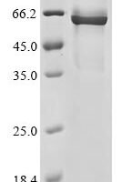 Human coronavirus OC43 Nucleoprotein (N) Recombinant Protein, N-10His/C-Myc, aa 1–448, Mammalian cell - BioCrest Sci