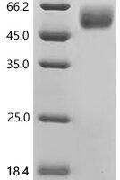 Mouse Tumor necrosis factor receptor superfamily member 1A (Tnfrsf1a), partial Recombinant Protein - BioCrest Sci