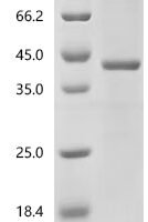 Plasmodium falciparum Thrombospondin-related anonymous protein (TRAP), partial Recombinant Protein, C-His, aa 26–287, E.coli - BioCrest Sci