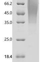Human Leukosialin (SPN), partial Recombinant Protein, C-10His - BioCrest Sci