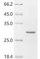 Mouse Synaptotagmin-like protein 1 (Sytl1), partial Recombinant Protein - BioCrest Sci