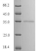 Bovine Mannose-binding protein C (MBL) Recombinant Protein, N-Flag-Myc - BioCrest Sci