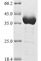 Human Neurofilament medium polypeptide (NEFM), partial Recombinant Protein, C-His - BioCrest Sci