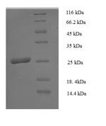 Human HLA class II histocompatibility antigen, DP beta 1 chain (HLA-DPB1), partial Recombinant Protein, N-His - BioCrest Sci
