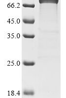 Human Myosin-6 (MYH6), partial Recombinant Protein, C-His - BioCrest Sci