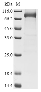 Human Myosin-6 (MYH6), partial Recombinant Protein, C-His, Homo sapiens (Human), Baculovirus, C-terminal 6xHis-tagged, 80.4 kDa, purity >≥ 90% as determined by SDS-PAGE.