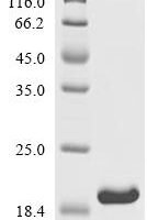 Human Tight junction protein 2 (TJP2), partial Recombinant Protein - BioCrest Sci