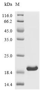 Human Tight junction protein 2 (TJP2), partial Recombinant Protein, Homo sapiens (Human), E.coli, C-terminal 6xHis-tagged, 16.3 kDa, purity >≥ 95% as determined by SDS-PAGE.