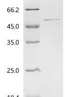 Human Glutamine synthetase (GLUL) Recombinant Protein - BioCrest Sci