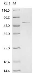 Human Glutamine synthetase (GLUL) Recombinant Protein, Homo sapiens (Human), E.coli, C-terminal 6xHis-tagged, 48.8 kDa, purity >≥ 90% as determined by SDS-PAGE.