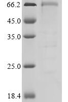 Human Liver carboxylesterase 1 (CES1) Recombinant Protein - BioCrest Sci