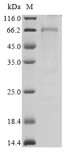 Human Liver carboxylesterase 1 (CES1) Recombinant Protein, Homo sapiens (Human), Baculovirus, C-terminal 6xHis-tagged, 66.3 kDa, purity >≥ 85% as determined by SDS-PAGE.
