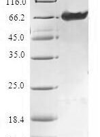 Human Tropomodulin-4 (TMOD4) Recombinant Protein - BioCrest Sci